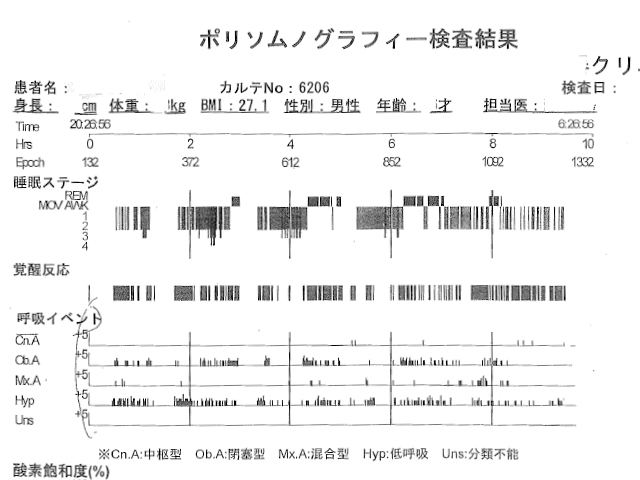 睡眠時無呼吸イメージ